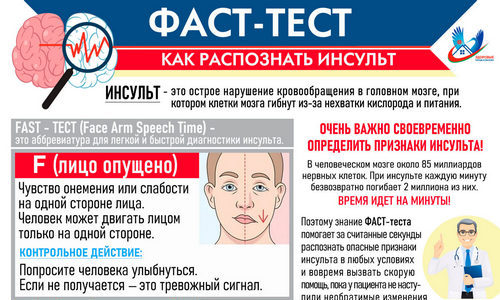 Фаст-тест «Как распознать инсульт»